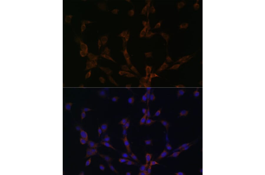 Immunofluorescence - Anti-Dynein Antibody (A88133) - Antibodies.com