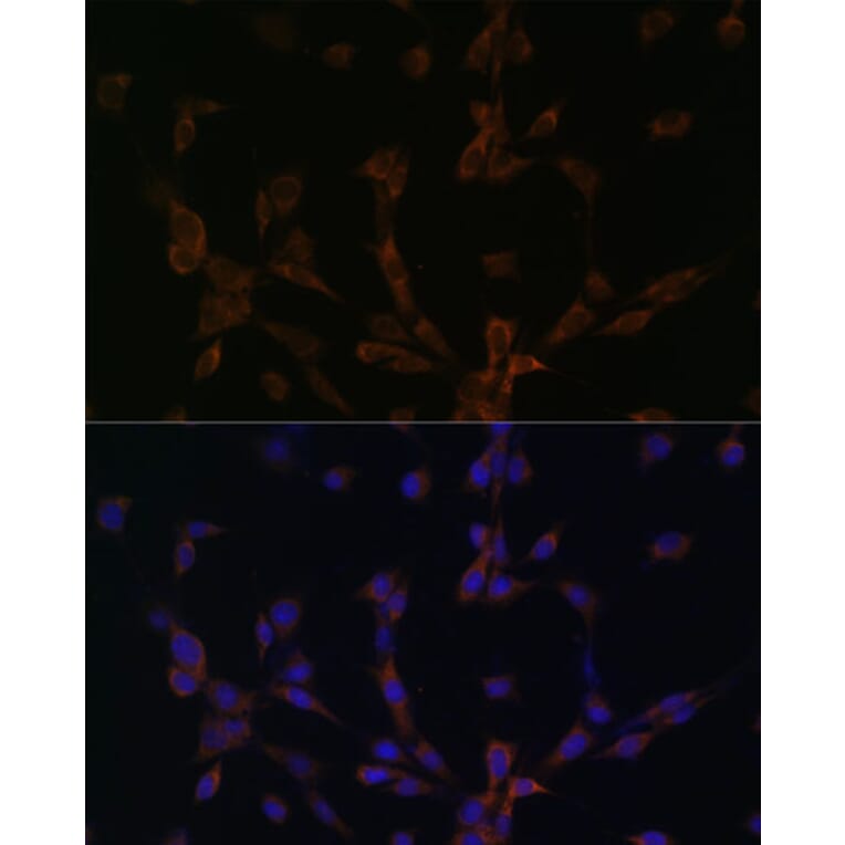 Immunofluorescence - Anti-Dynein Antibody (A88133) - Antibodies.com