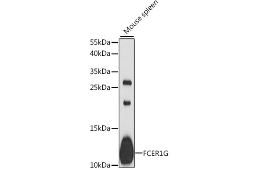 Western Blot - Anti-FcRgamma Antibody (A88134) - Antibodies.com
