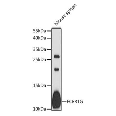 Western Blot - Anti-FcRgamma Antibody (A88134) - Antibodies.com