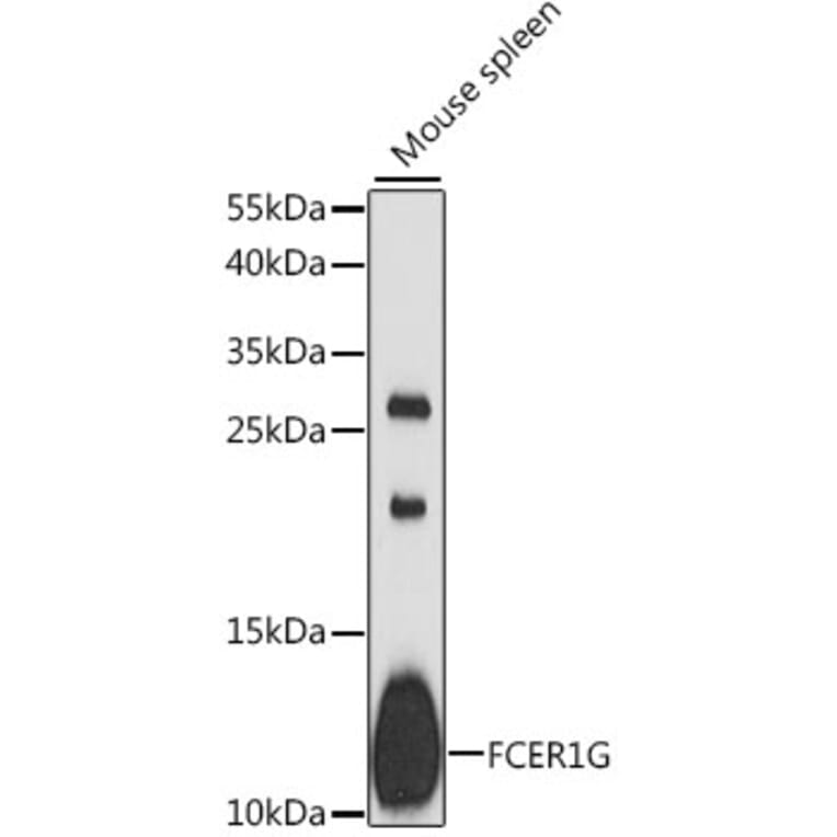 Western Blot - Anti-FcRgamma Antibody (A88134) - Antibodies.com
