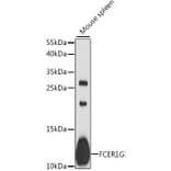 Western Blot - Anti-FcRgamma Antibody (A88134) - Antibodies.com