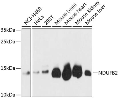 Western blot analysis of extracts of various cell lines, using Anti-NDUFB2 Antibody (A3978) at 1:3000 dilution.
Secondary antibody: Goat Anti-Rabbit IgG (H+L) (HRP) (AS014) at 1:10,000 dilution.
Lysates / proteins: 25µg per lane.
Blocking buffer: 3% non-fat dry milk in TBST.
Detection: ECL Basic Kit (RM00020).
Exposure time: 30s.