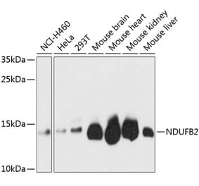 Western Blot - Anti-NDUFB2 Antibody (A88135) - Antibodies.com