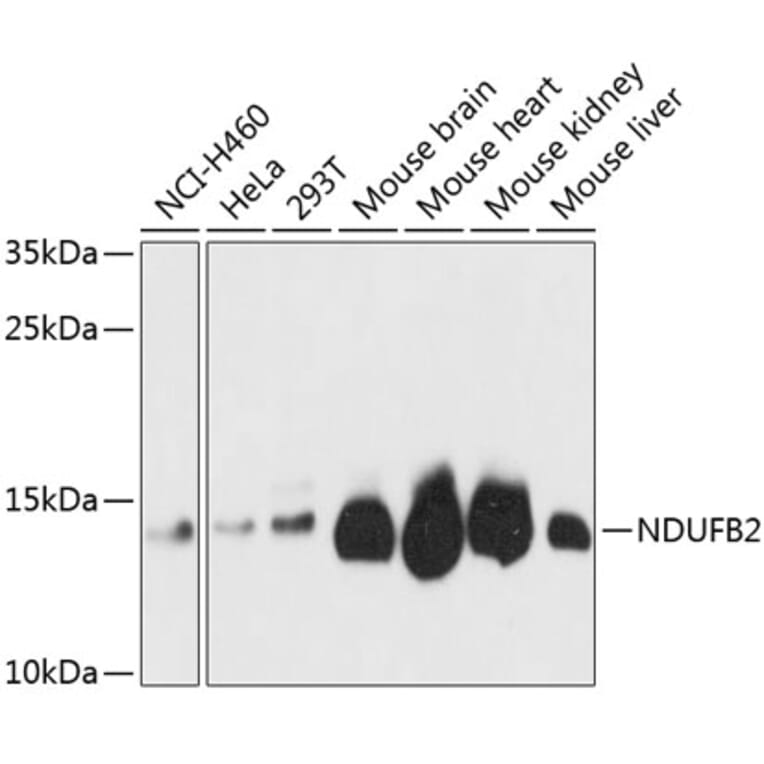 Western Blot - Anti-NDUFB2 Antibody (A88135) - Antibodies.com