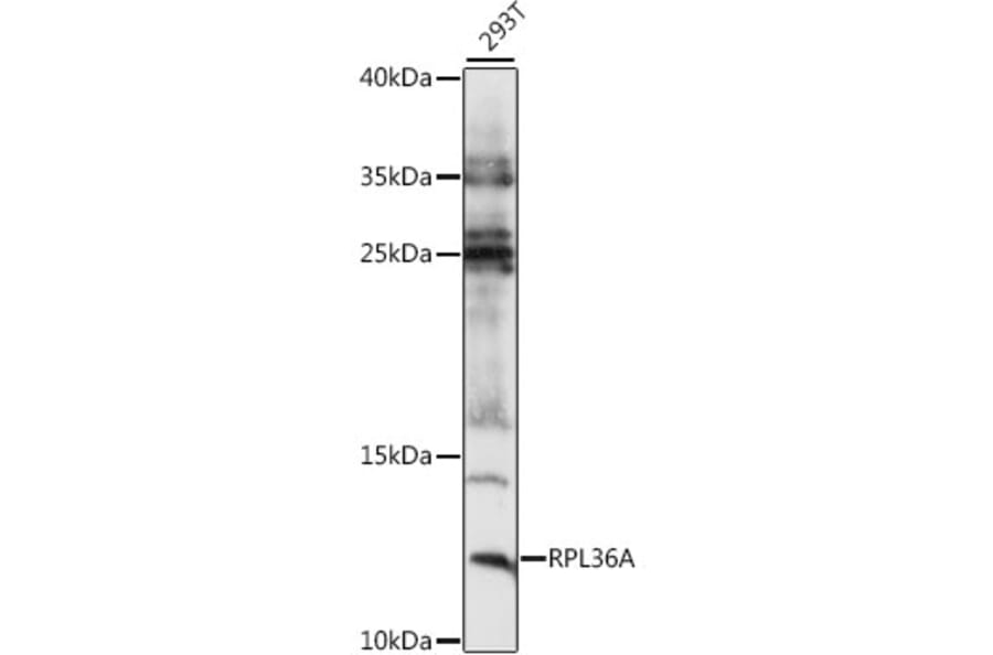 Western Blot - Anti-RPL36A Antibody (A88136) - Antibodies.com