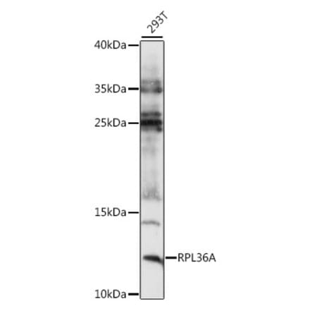 Western Blot - Anti-RPL36A Antibody (A88136) - Antibodies.com
