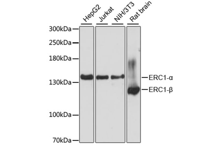 Western Blot - Anti-ELKS Antibody (A88137) - Antibodies.com