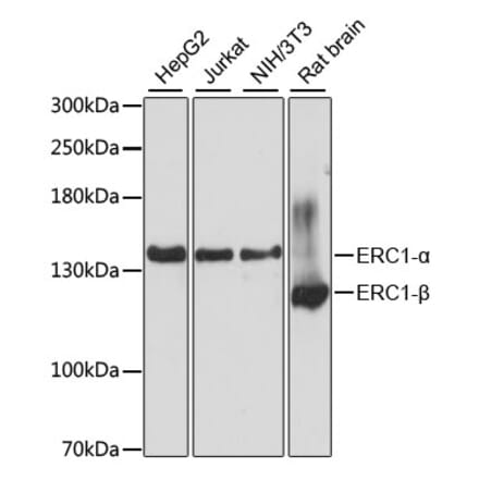 Western Blot - Anti-ELKS Antibody (A88137) - Antibodies.com