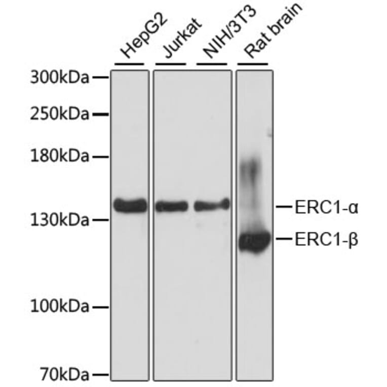 Western Blot - Anti-ELKS Antibody (A88137) - Antibodies.com