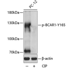 Western Blot - Anti-BCAR1 (phospho Tyr165) Antibody (A88138) - Antibodies.com