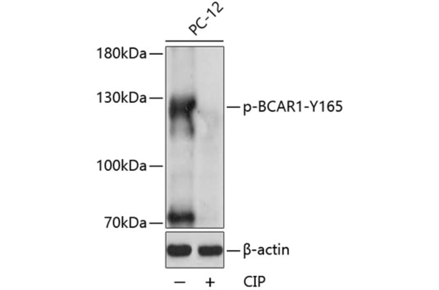 Western Blot - Anti-BCAR1 (phospho Tyr165) Antibody (A88138) - Antibodies.com
