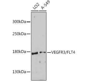 Western Blot - Anti-VEGF Receptor 3 Antibody (A88139) - Antibodies.com
