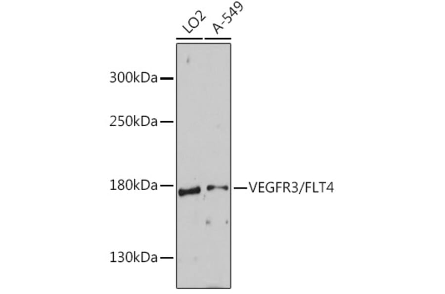 Western Blot - Anti-VEGF Receptor 3 Antibody (A88139) - Antibodies.com