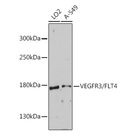 Western Blot - Anti-VEGF Receptor 3 Antibody (A88139) - Antibodies.com