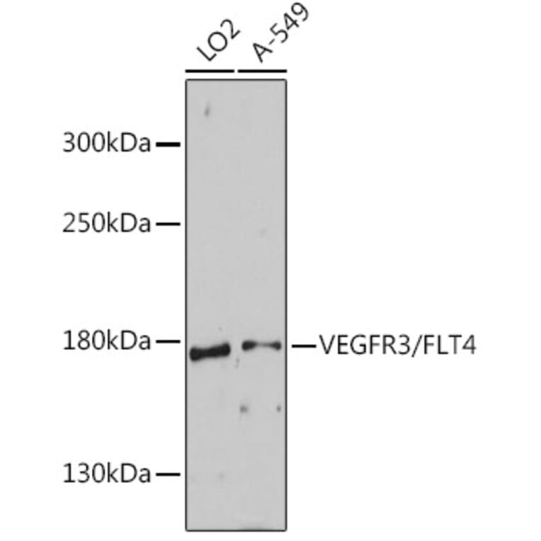 Western Blot - Anti-VEGF Receptor 3 Antibody (A88139) - Antibodies.com
