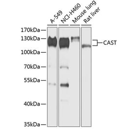 Western Blot - Anti-Calpastatin Antibody (A88141) - Antibodies.com