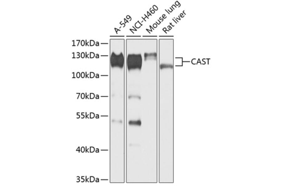 Western Blot - Anti-Calpastatin Antibody (A88141) - Antibodies.com