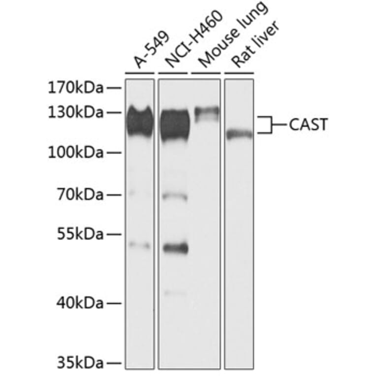 Western Blot - Anti-Calpastatin Antibody (A88141) - Antibodies.com
