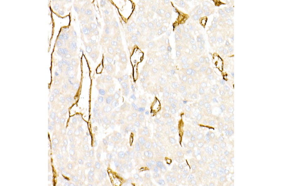 Immunohistochemistry - Anti-CD31 Antibody (A88142) - Antibodies.com