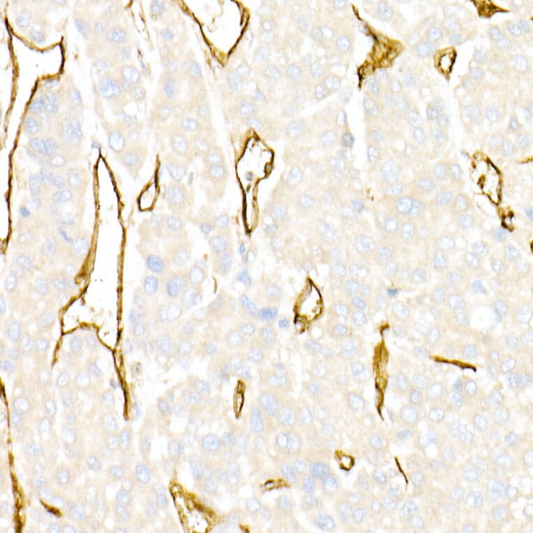 Immunohistochemistry - Anti-CD31 Antibody (A88142) - Antibodies.com