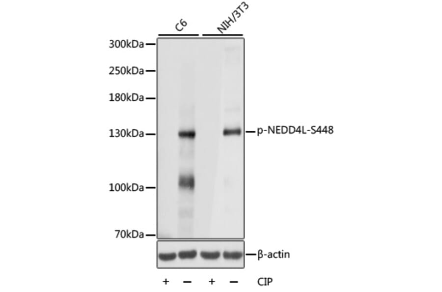 Western Blot - Anti-NEDD4-2 (phospho Ser448) Antibody (A88143) - Antibodies.com