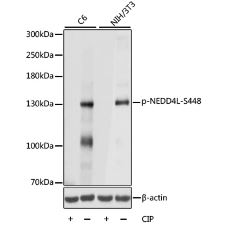 Western Blot - Anti-NEDD4-2 (phospho Ser448) Antibody (A88143) - Antibodies.com