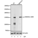 Western Blot - Anti-NEDD4-2 (phospho Ser448) Antibody (A88143) - Antibodies.com