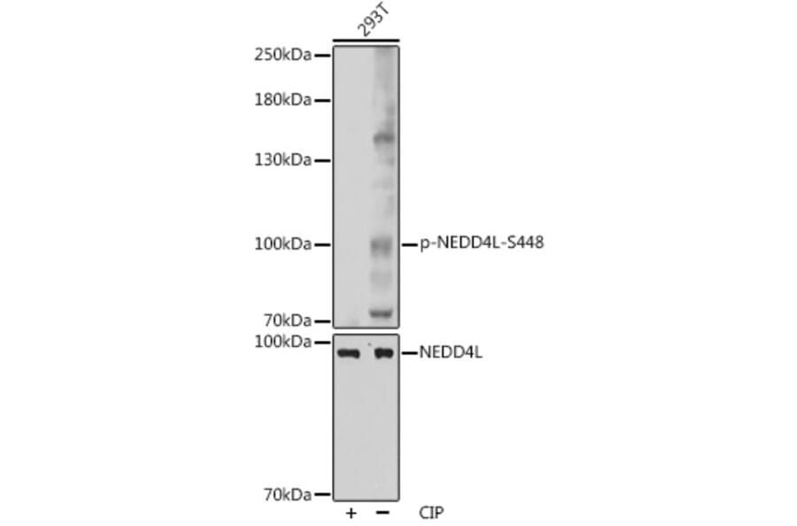 Western Blot - Anti-NEDD4-2 (phospho Ser448) Antibody (A88143) - Antibodies.com