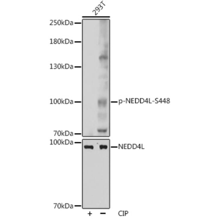 Western Blot - Anti-NEDD4-2 (phospho Ser448) Antibody (A88143) - Antibodies.com