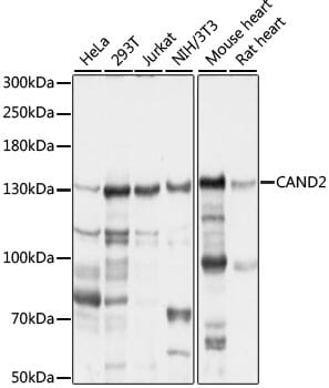 Western blot analysis of extracts of various cell lines, using Anti-CAND2 Antibody (A16500) at 1:1,000 dilution.
Secondary antibody: Goat Anti-Rabbit IgG (H+L) (HRP) (AS014) at 1:10,000 dilution.
Lysates / proteins: 25µg per lane.
Blocking buffer: 3% non-fat dry milk in TBST.
Detection: ECL Basic Kit (RM00020).
Exposure time: 15s.
