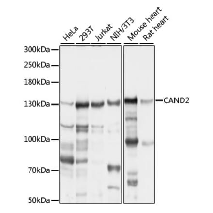 Western Blot - Anti-CAND2 Antibody (A88144) - Antibodies.com