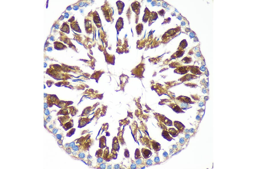 Immunohistochemistry - Anti-CAND2 Antibody (A88144) - Antibodies.com