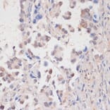 Immunohistochemistry - Anti-Tat-SF1 Antibody (A88145) - Antibodies.com