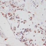 Immunohistochemistry - Anti-Tat-SF1 Antibody (A88145) - Antibodies.com