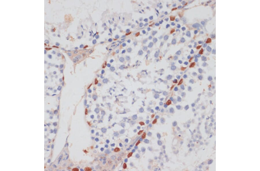 Immunohistochemistry - Anti-Tat-SF1 Antibody (A88145) - Antibodies.com