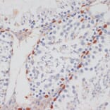 Immunohistochemistry - Anti-Tat-SF1 Antibody (A88145) - Antibodies.com