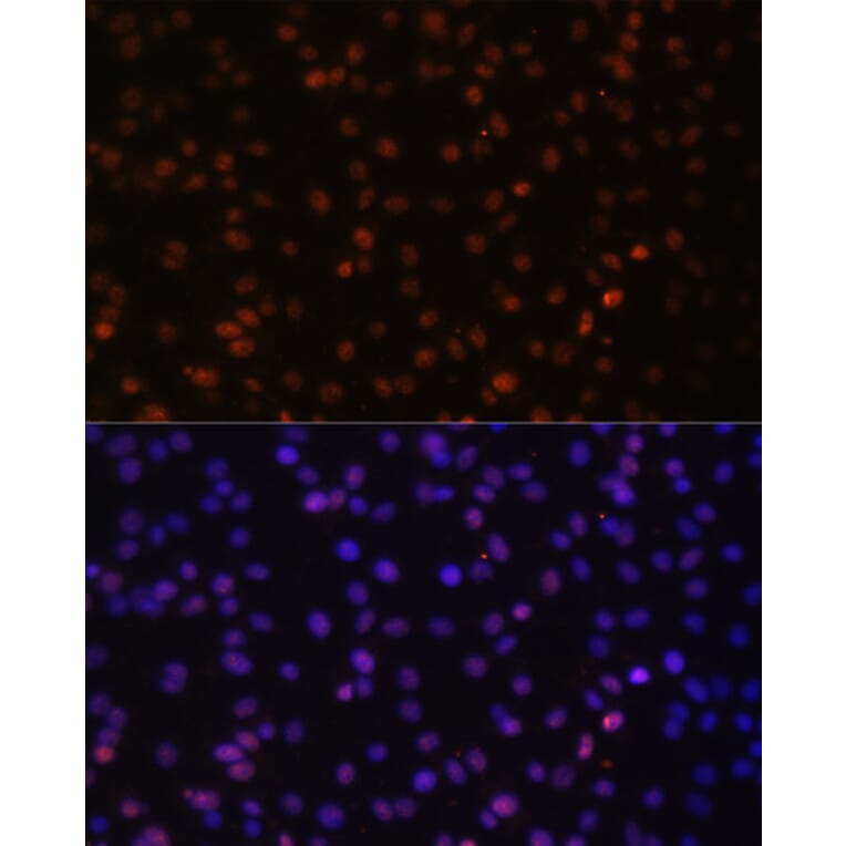 Immunofluorescence - Anti-Tat-SF1 Antibody (A88145) - Antibodies.com