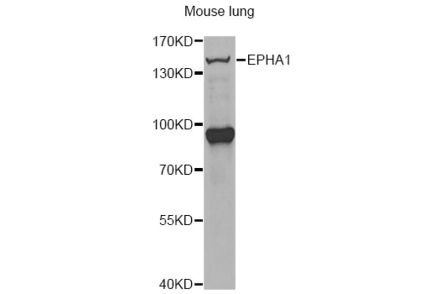 Western Blot - Anti-EPHA1 Antibody (A13301) - Antibodies.com