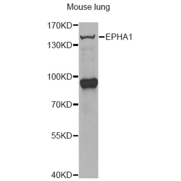 Western Blot - Anti-EPHA1 Antibody (A13301) - Antibodies.com