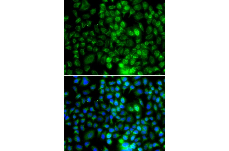 Immunofluorescence - Anti-EPHA1 Antibody (A13301) - Antibodies.com