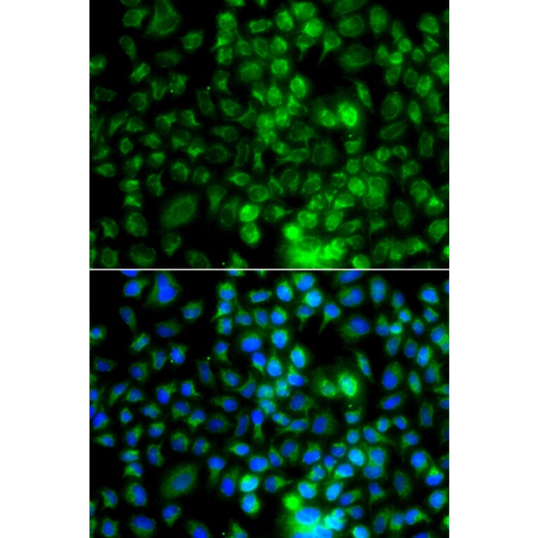 Immunofluorescence - Anti-EPHA1 Antibody (A13301) - Antibodies.com
