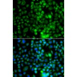 Immunofluorescence - Anti-EPHA1 Antibody (A13301) - Antibodies.com