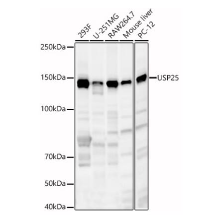 Western Blot - Anti-USP25 Antibody (A88148) - Antibodies.com
