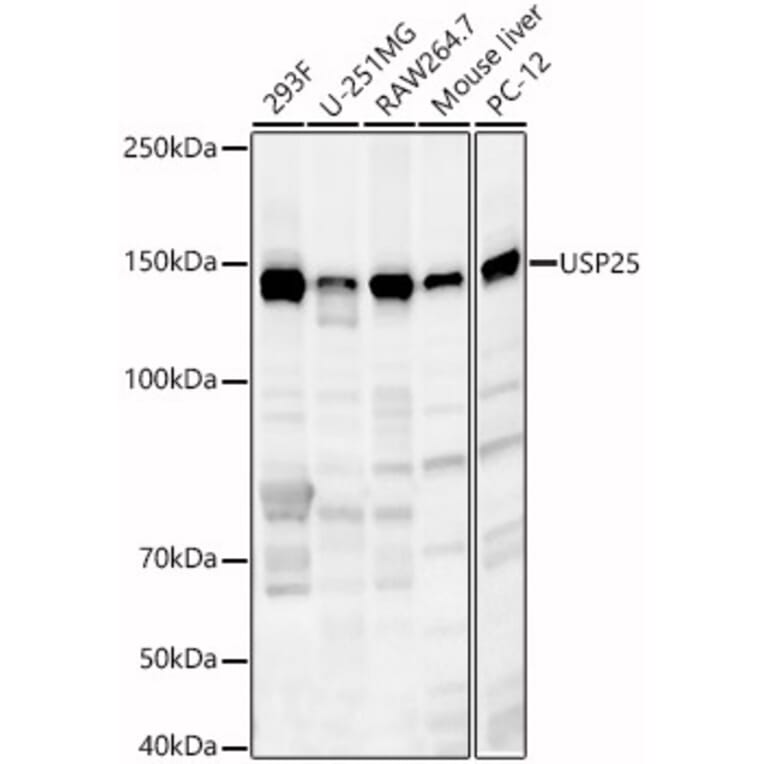 Western Blot - Anti-USP25 Antibody (A88148) - Antibodies.com