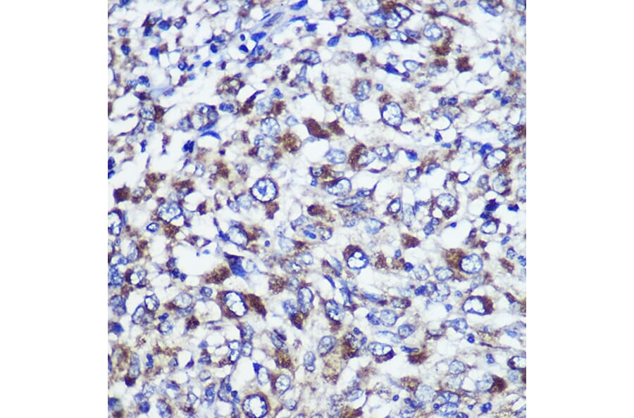 Immunohistochemistry - Anti-DIS3L Antibody (A88149) - Antibodies.com