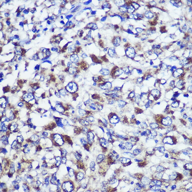 Immunohistochemistry - Anti-DIS3L Antibody (A88149) - Antibodies.com
