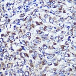 Immunohistochemistry - Anti-DIS3L Antibody (A88149) - Antibodies.com