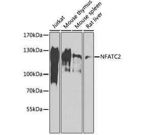 Western Blot - Anti-NFAT1 Antibody (A88150) - Antibodies.com