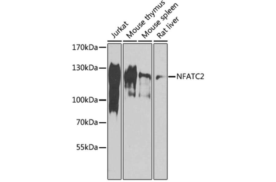Western Blot - Anti-NFAT1 Antibody (A88150) - Antibodies.com